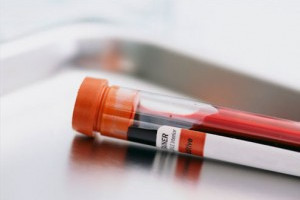 PvdA Zuid-Holland: ‘Provincie moet bloedonderzoek omwonenden DuPont/Chemours vergoeden’